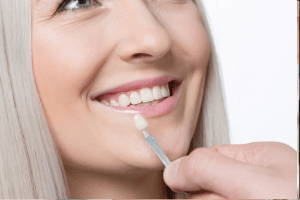 Dental Veneer Treatment 2
