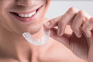 Mouthguard-For-Teeth-Grinding