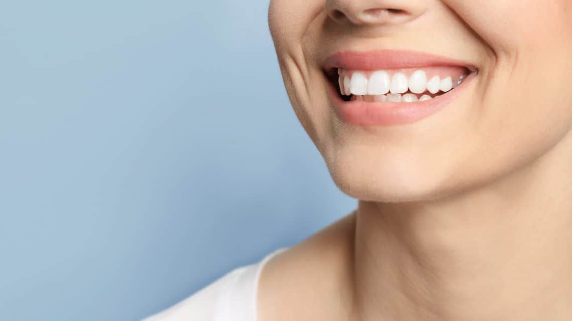Lady-With-White-Strong-Teeth