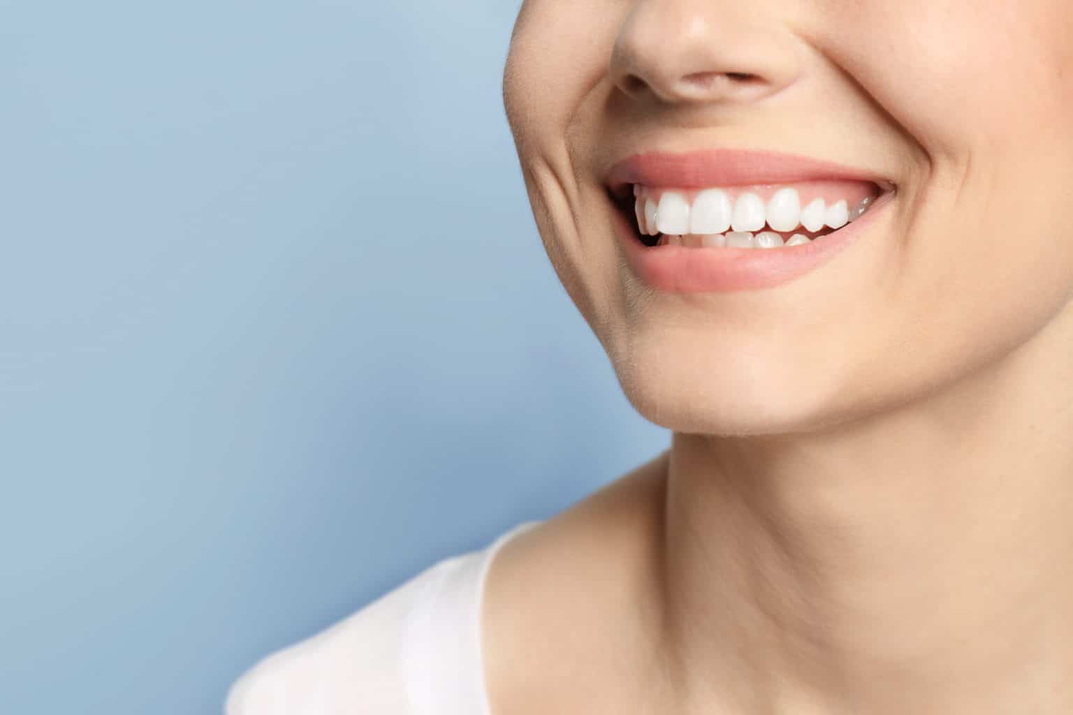 Teeth Whitening Cost