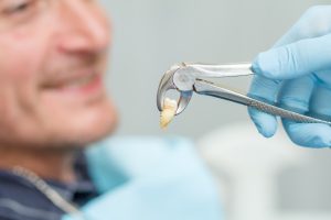 Man with tooth taken out