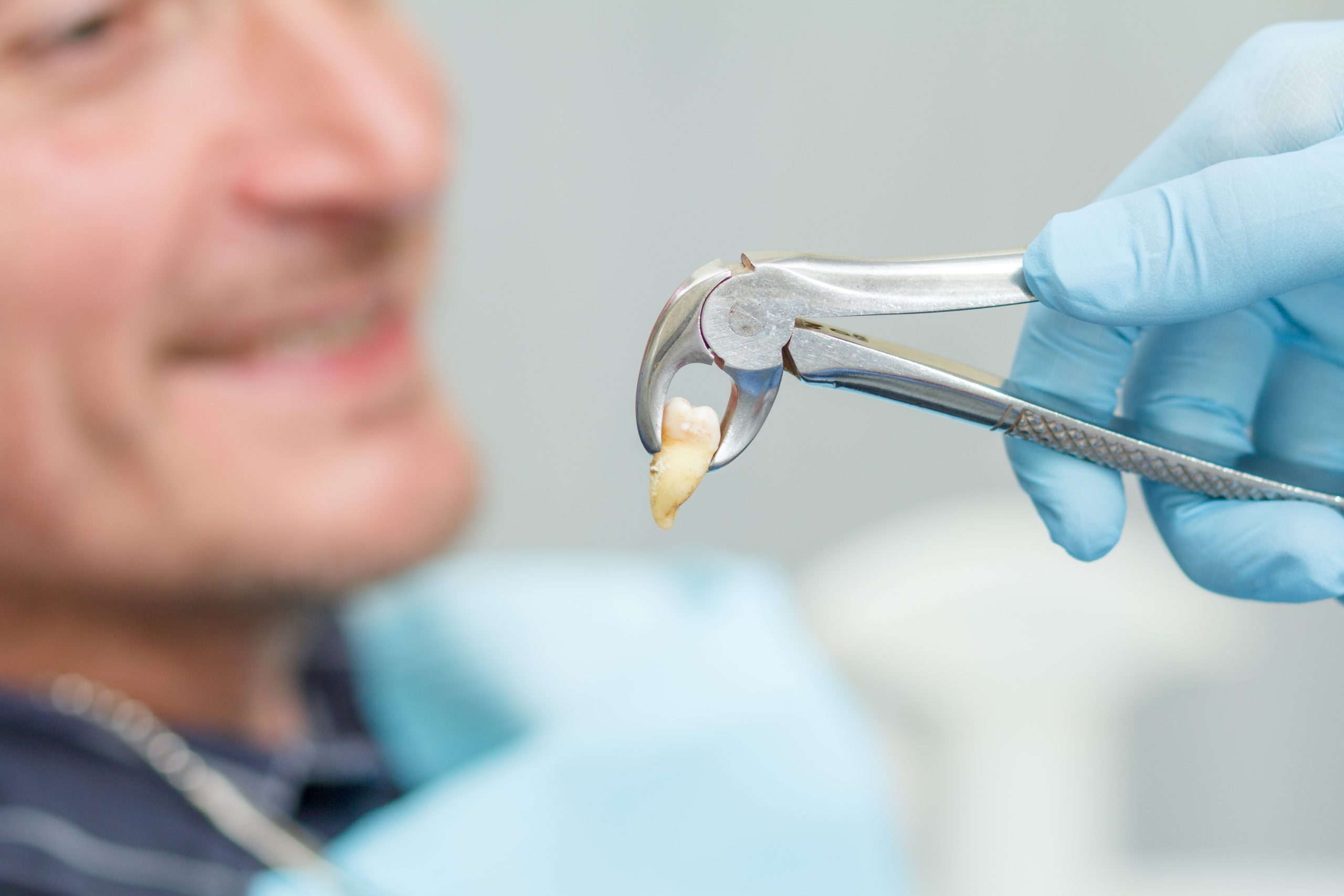 Reduce Bone Loss For Missing Teeth - Sutherland Dental