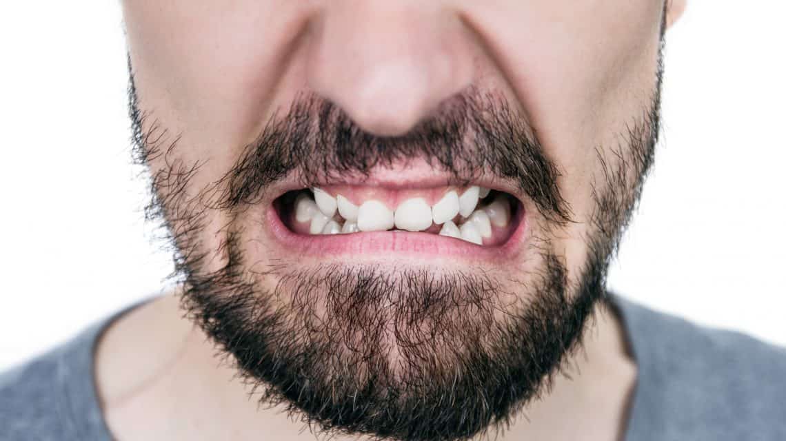 patient-with-crooked-teeth-due-to-teeth-grinding