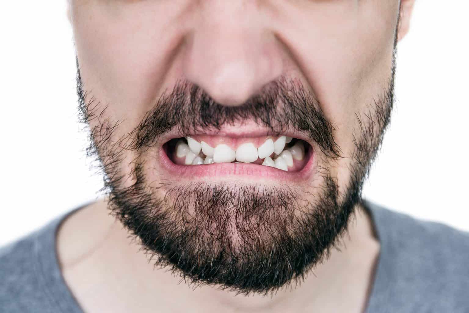 patient-with-crooked-teeth-due-to-teeth-grinding