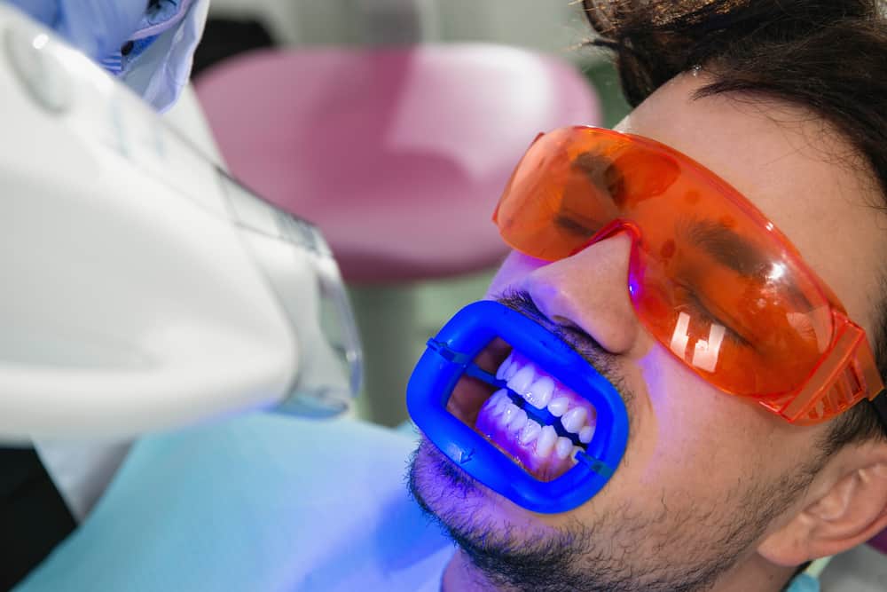 Interesting Facts About Teeth Whitening That You Must Know