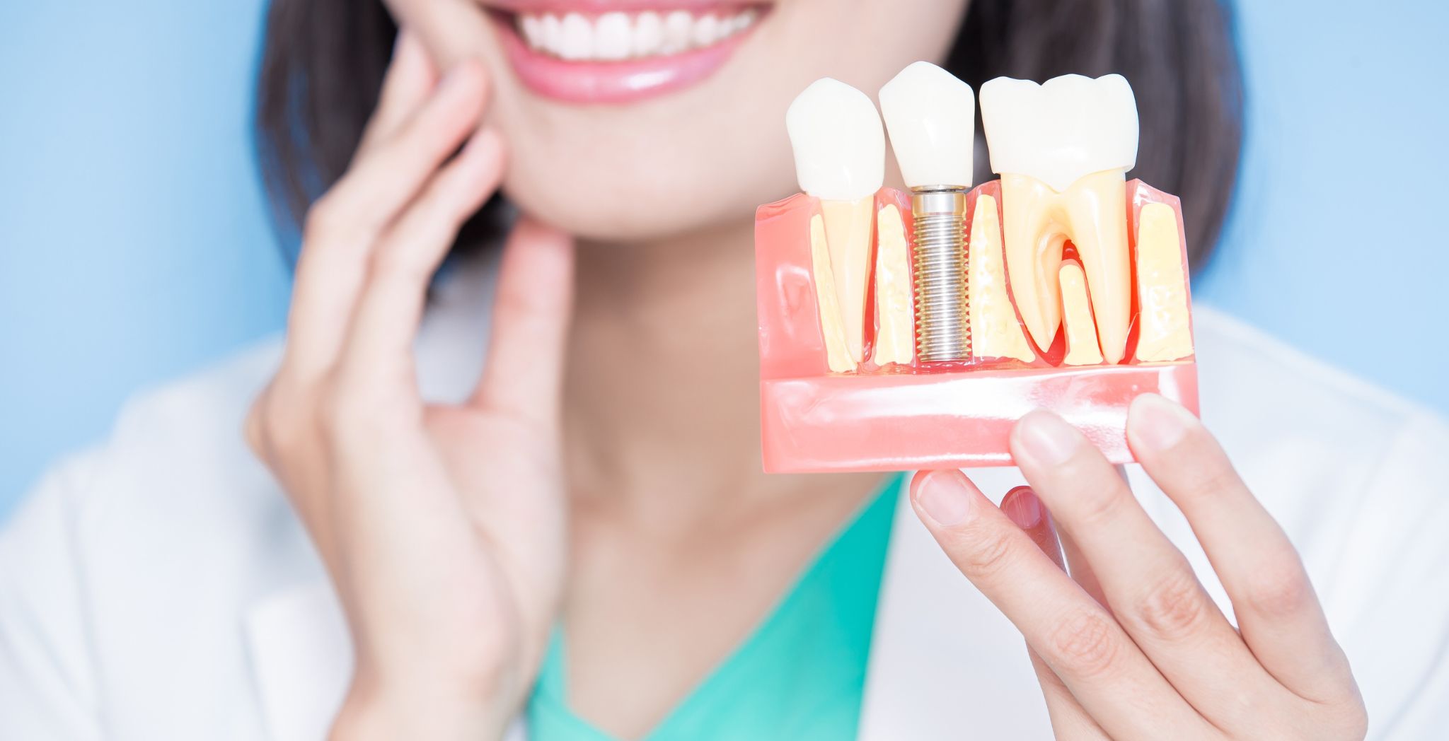 Post-dental implant care tips, Caring for dental implants after surgery, Dental implant recovery